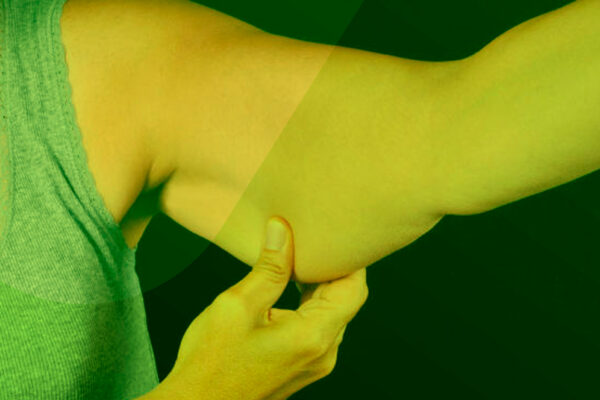L-sarcopenia